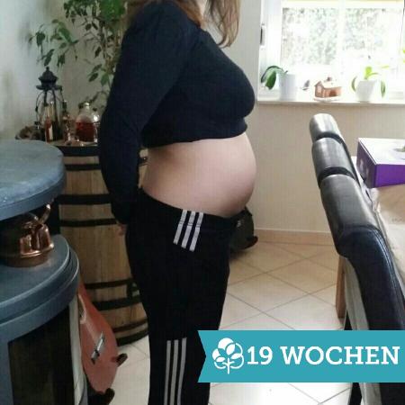 Übergewicht schwangerschaftsbauch