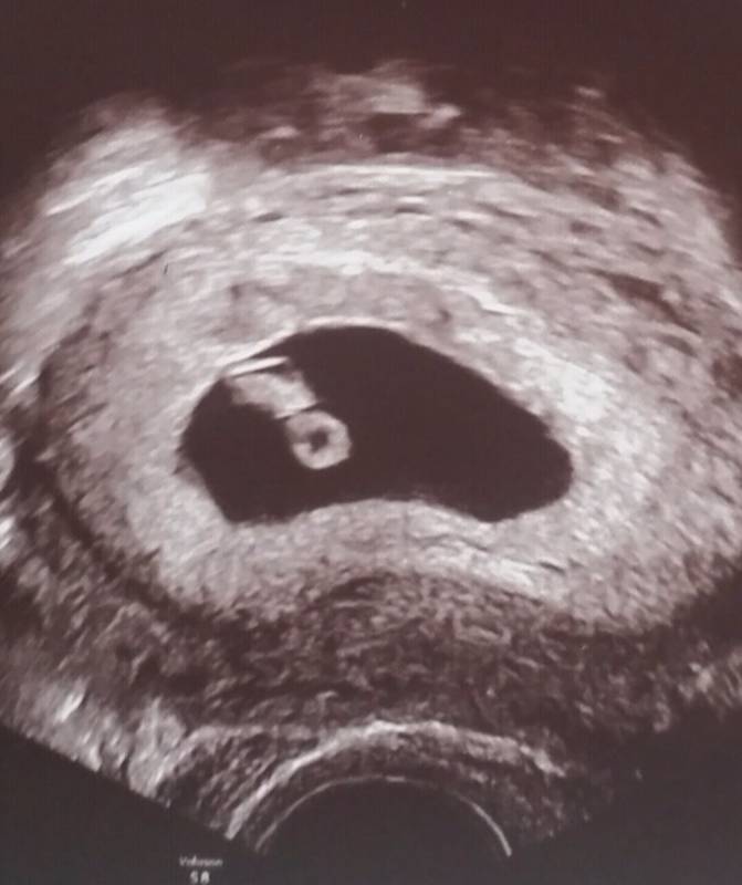 schwanger ab wann geschlecht erkennbar