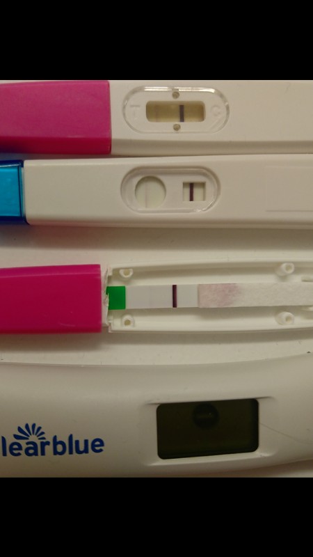 Positiver schwangerschaftstest durch zyste
