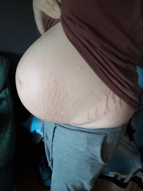 Gesenkt schwangerschaft bauch ᐅ Bauch