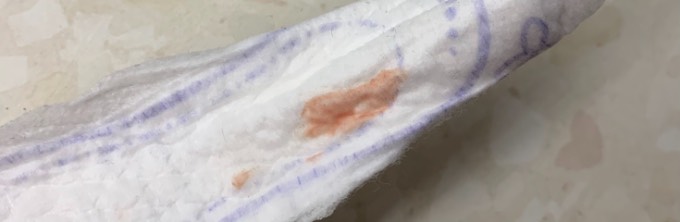 Einnistungsblutung toilettenpapier