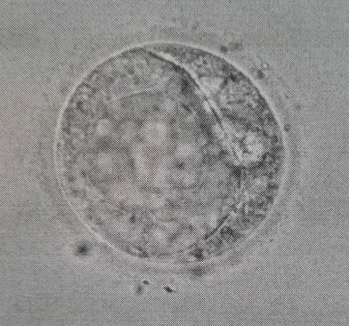 Wie viele eizellen schaffen es zur blastozyste